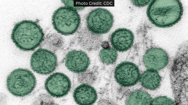 Hantavirus_Photo_Credit_CDC.jpg