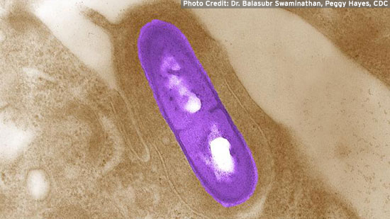 listeria.jpg