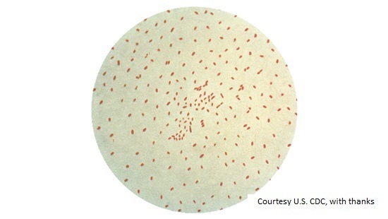 Pertussis.jpg