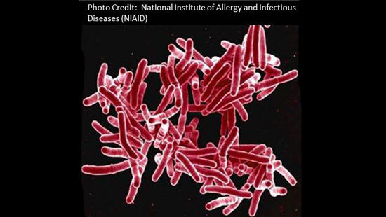 tuberculosis2.jpg